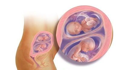 Беременность двойней на 19 неделе (фото)