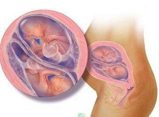 Беременность двойней на 22 неделе (фото) 1