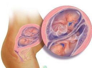 Беременность двойней на 26 неделе (фото)
