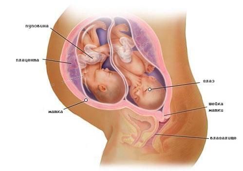 Беременность двойней на 28 неделе (фото)
