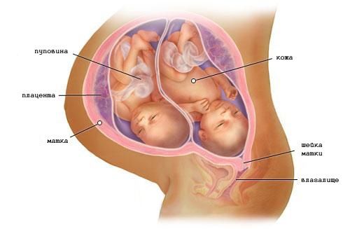 Беременность двойней на 36 неделе (фото)