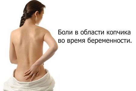 Боль в копчике при беременности