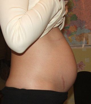 животик 22 неделя беременности 1