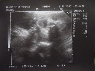 УЗИ 26 неделя беременности