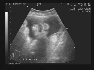 УЗИ 36 неделя беременности