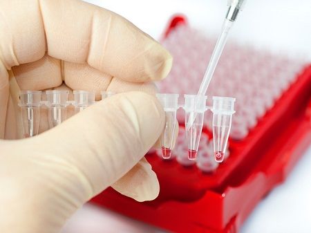 Как правильно сдать анализ крови на ХГЧ