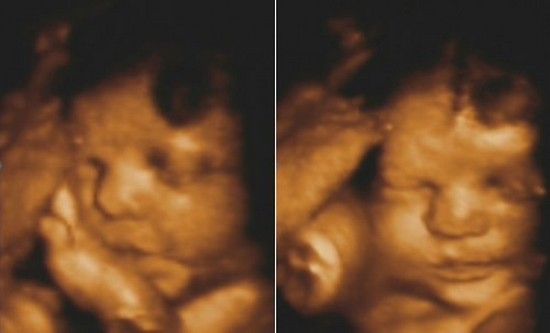 Фото УЗИ на 34 неделе 7